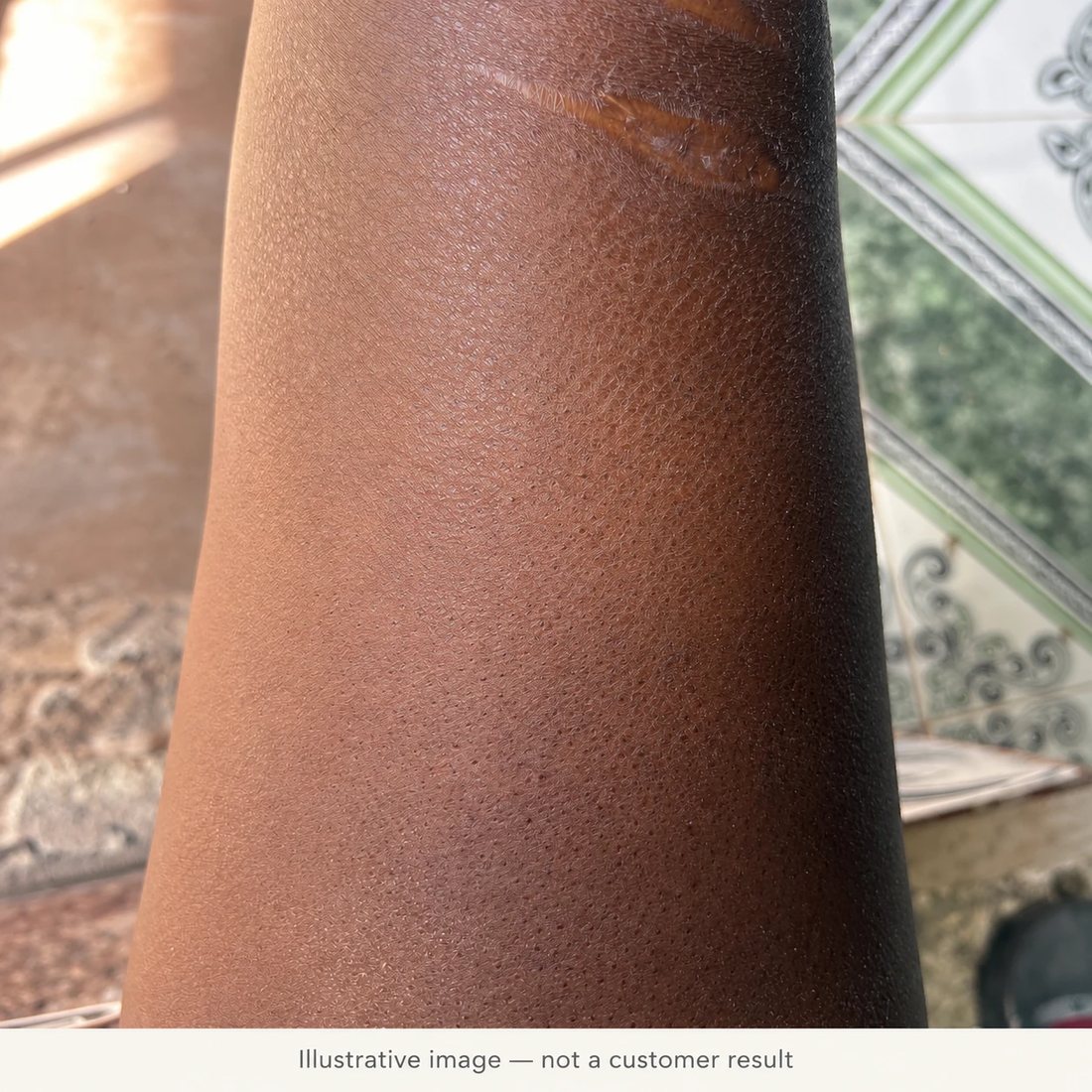 Close-up of rough, bumpy skin texture on an arm