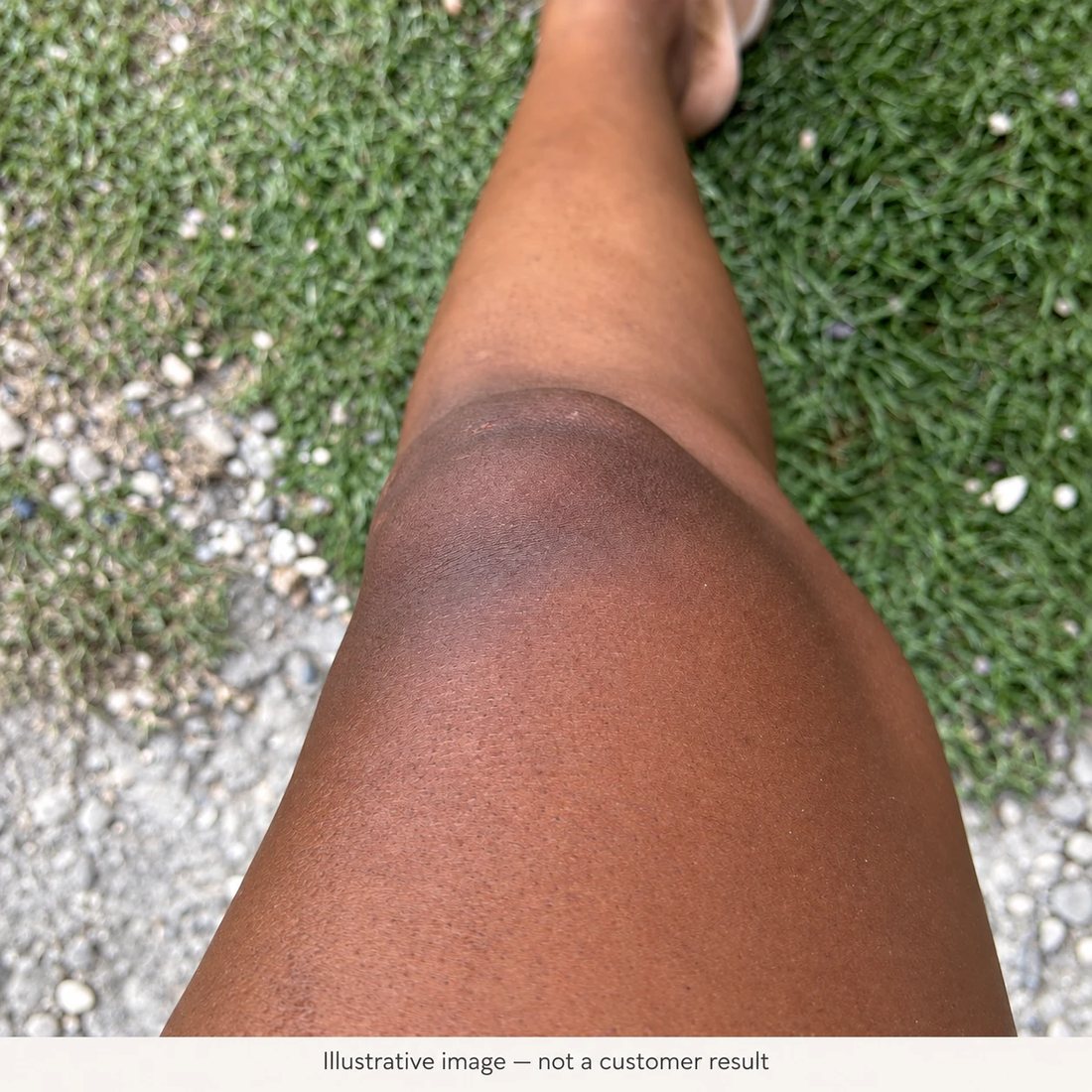 Knee with dull, uneven-looking skin
