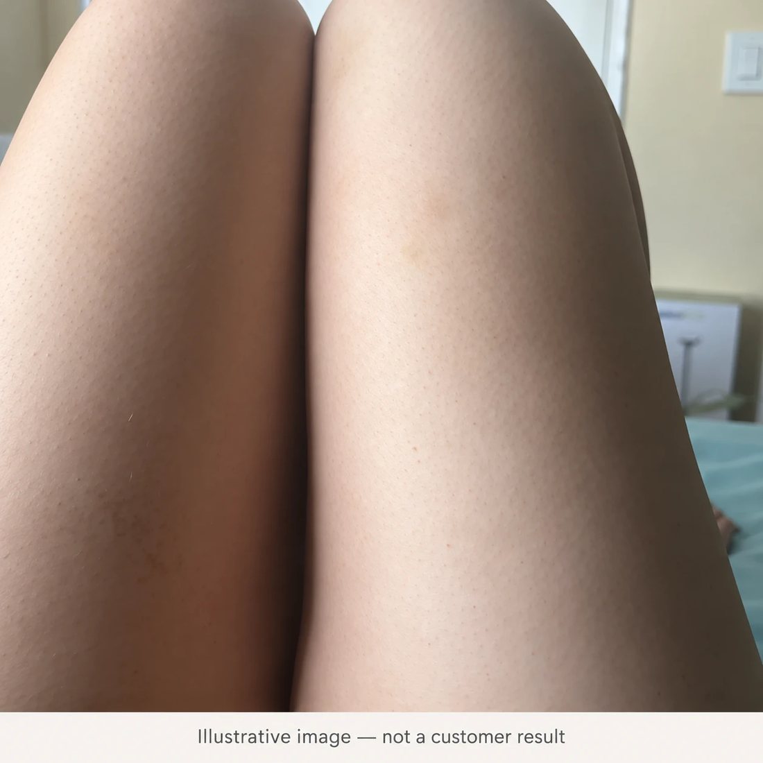Close-up of thighs with uneven-looking skin tone